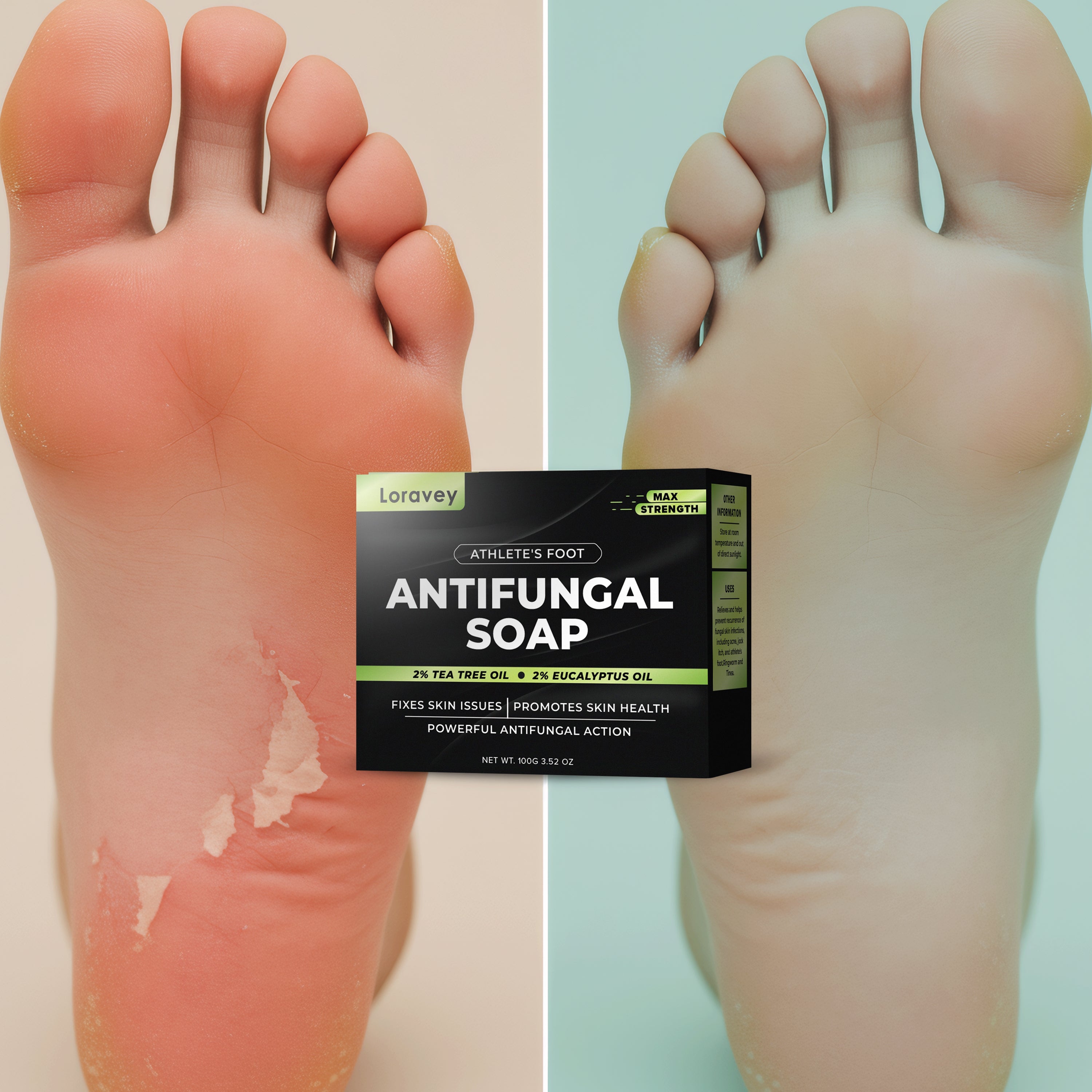 Loravey Maximum Strength Antifungal Soap
