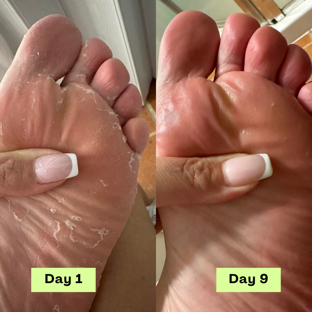 Dr. James® AntiFungal Soap Bar