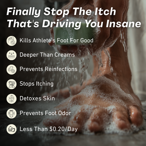 AntiFungal Soap Bar