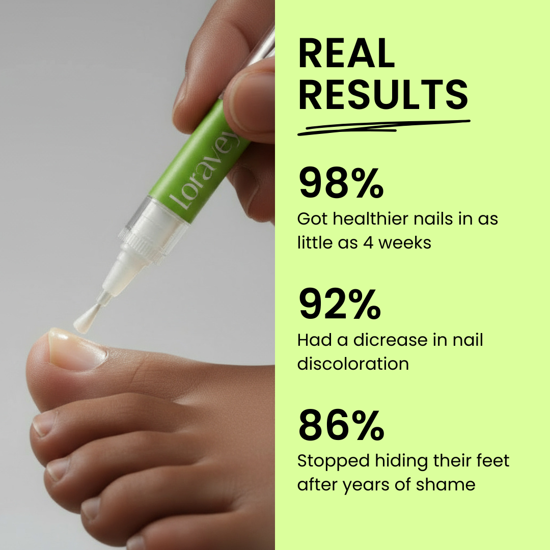 Loravey Nail Care Pen - 25% Undecylenic Acid