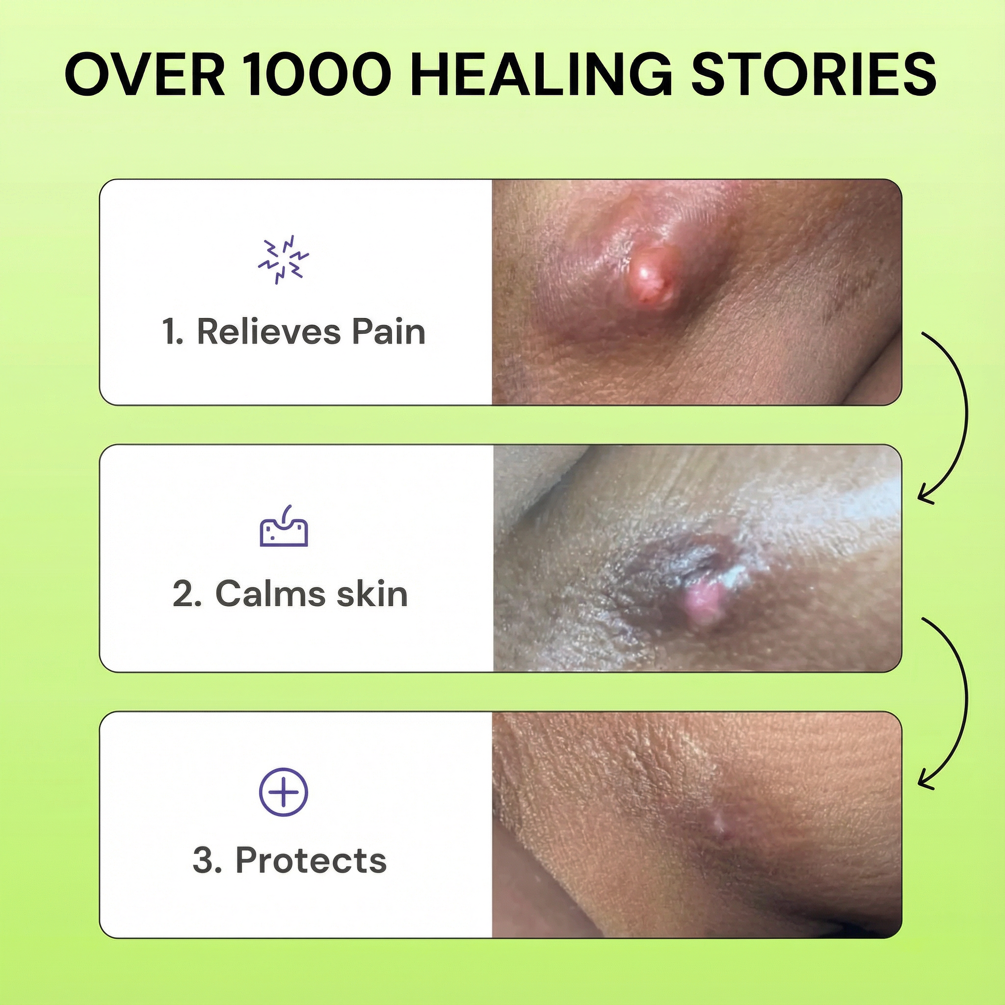 Loravey® Antimicrobial Relief Soap Bar