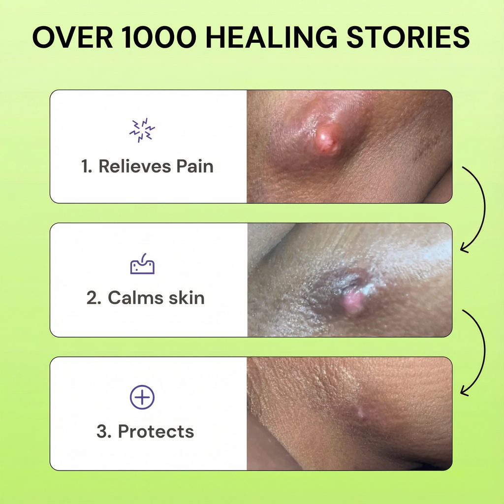 Loravey® Antimicrobial Relief Soap Bar