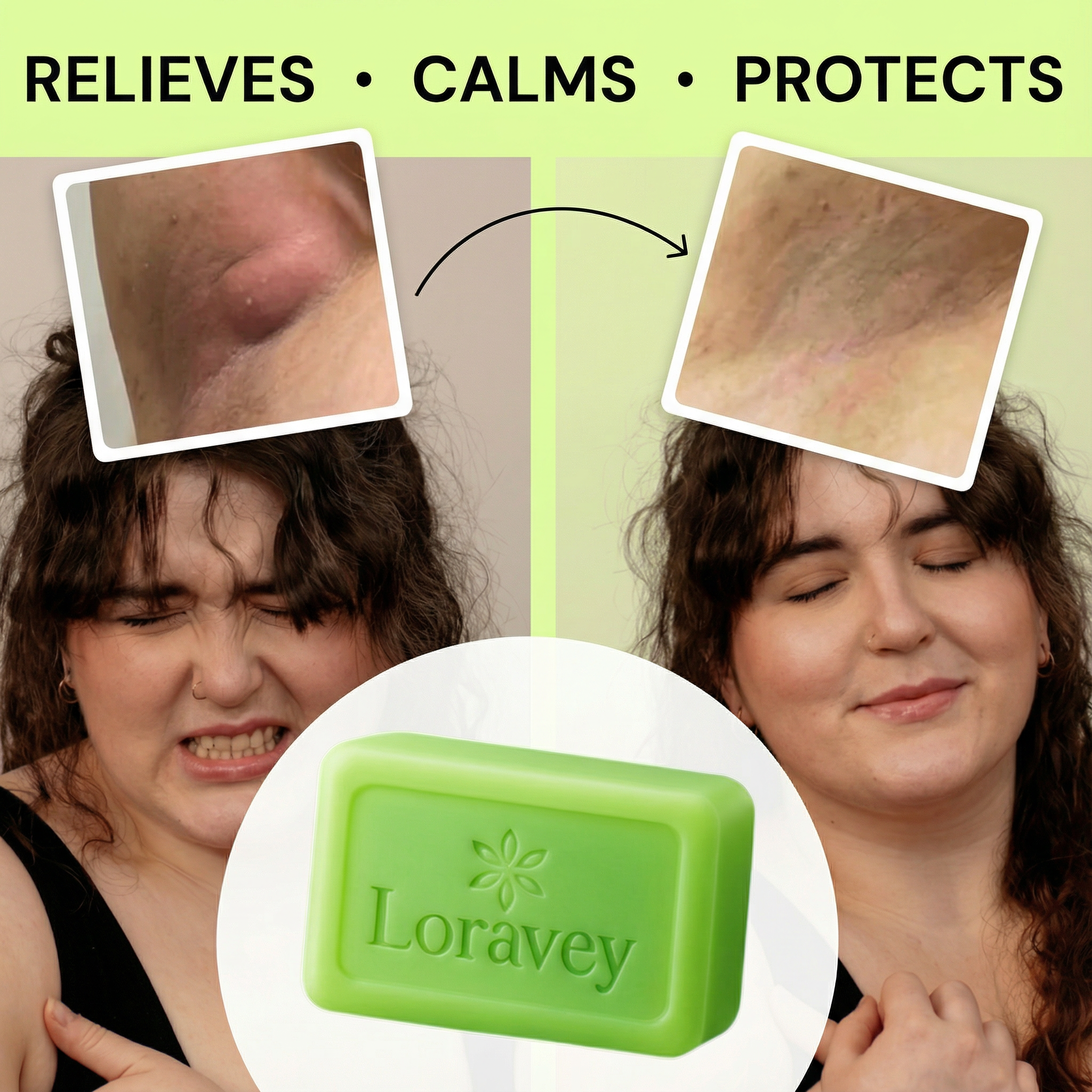 Loravey® Antimicrobial Relief Soap Bar