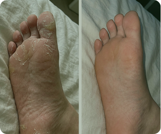 Before and after photos of a customer's soles